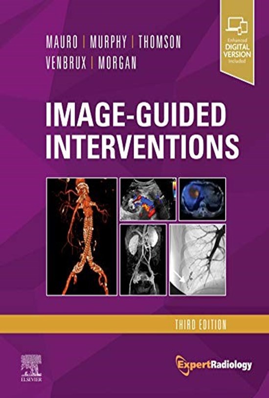 تصویر جلد کتاب Image-Guided Interventions: Expert Radiology Series, 3e 3rd Edition مداخلات هدایت شده مصور ویرایش سوم (زبان اصلی)