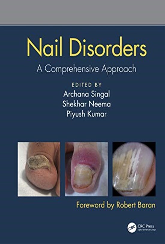 تصویر جلد کتاب Nail Disorders a Comprehensive Approach ناهنجاریهای ناخن، رویکردی جامع (زبان اصلی)