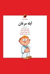 کتاب آبله‌ مرغان اثر الوین سیلوراستاین