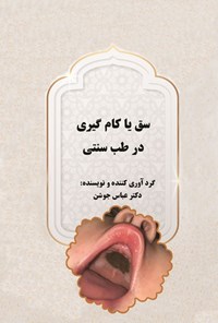 تصویر جلد کتاب سق یا کام گیری در طب سنتی