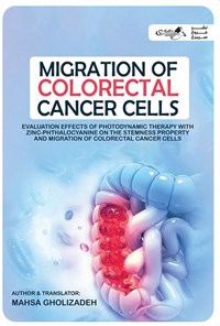 تصویر جلد کتاب Migration of Colorectal Cancer Cells