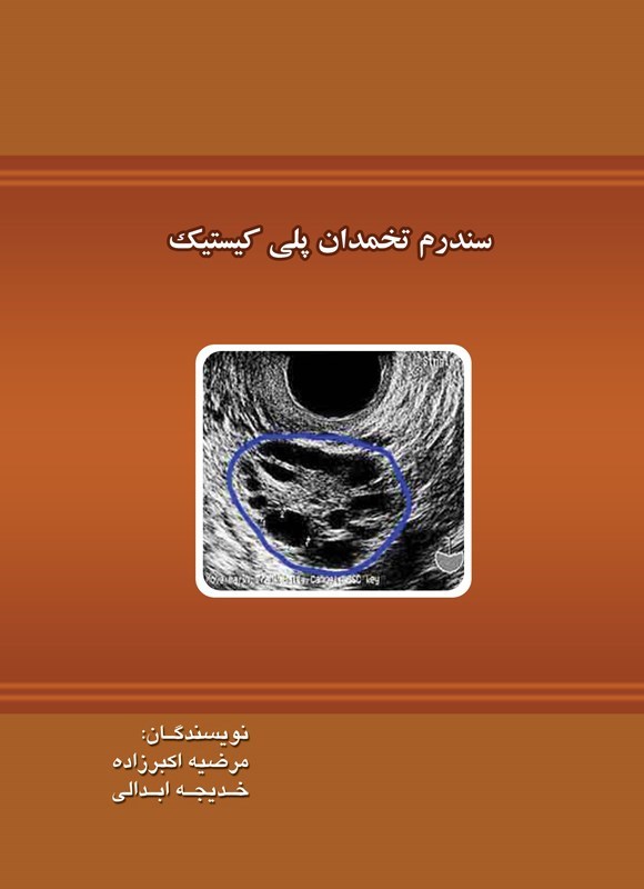 تصویر جلد کتاب سندرم تخمدان پلی کیستیک