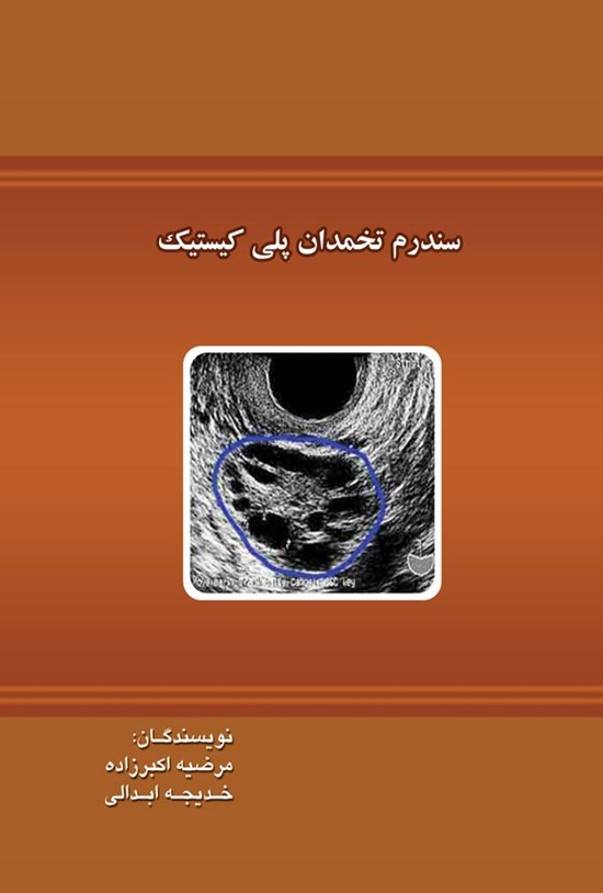 تصویر جلد کتاب سندرم تخمدان پلی کیستیک