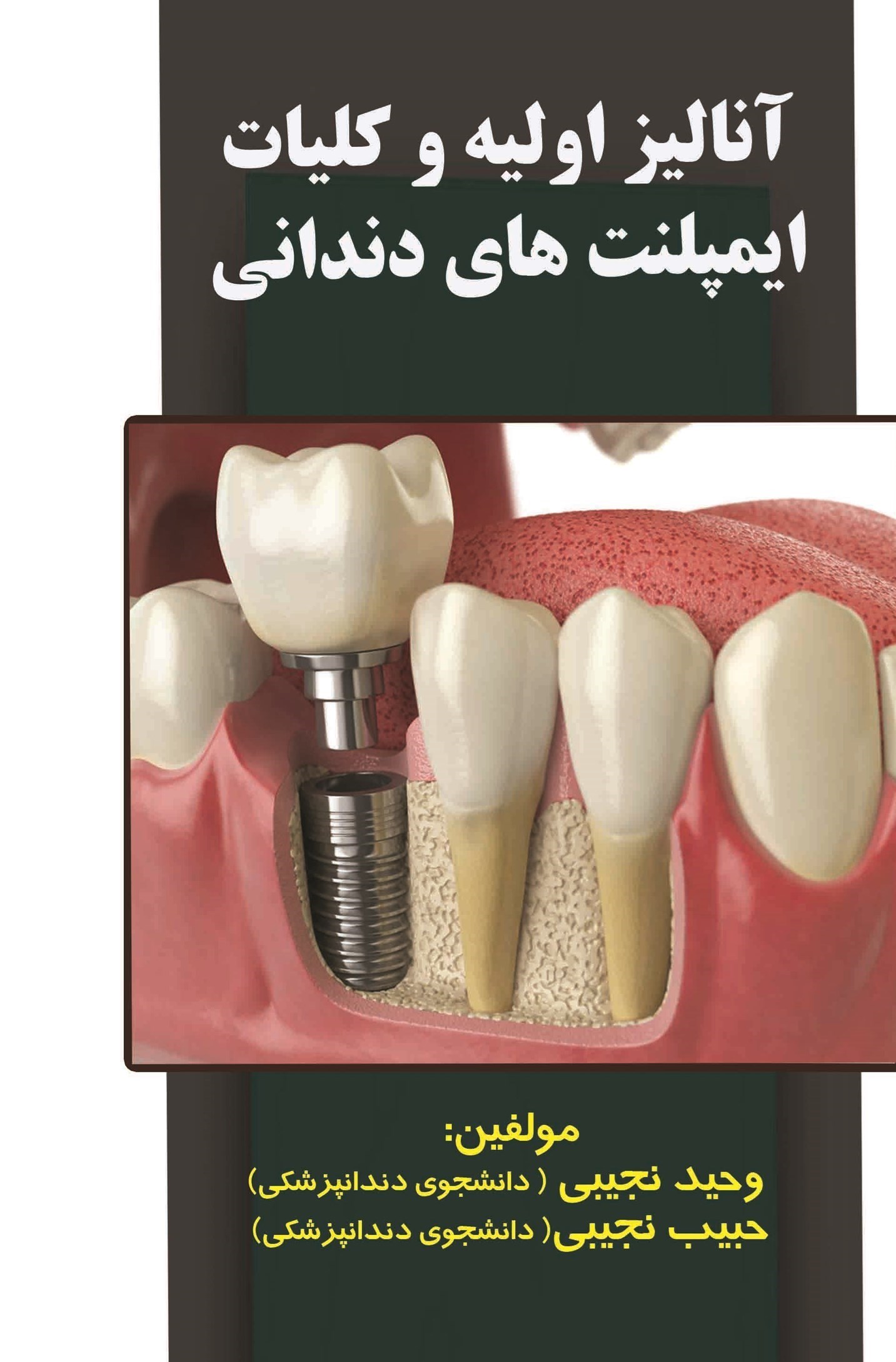 تصویر جلد کتاب آنالیز اولیه و کلیات ایمپلنت های دندانی