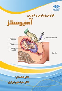 کتاب عوارض زودرس و دیررس آمنیوسنتز اثر فاطمه تارا