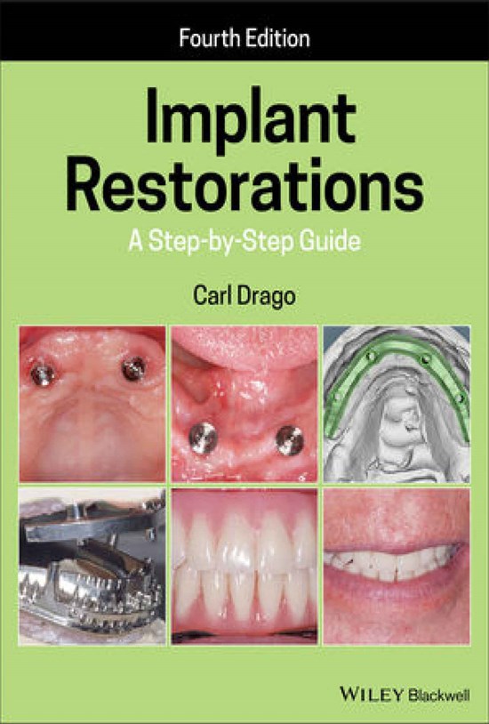تصویر جلد کتاب Implant Restorations؛ A Step-by-Step Guide