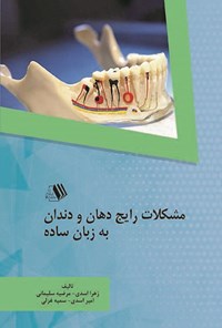 تصویر جلد کتاب مشکلات رایج دهان و دندان به زبان ساده